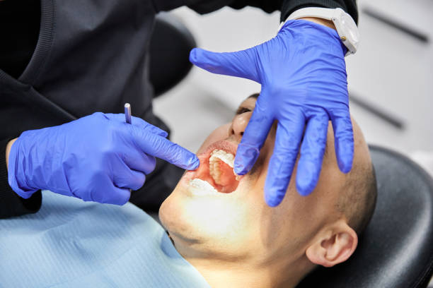 Best Emergency Dentist for Lost Fillings or Crowns in Pineville, NC